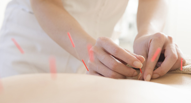 宏友会接骨院・宏友会鍼灸マッサージ院(三条市)